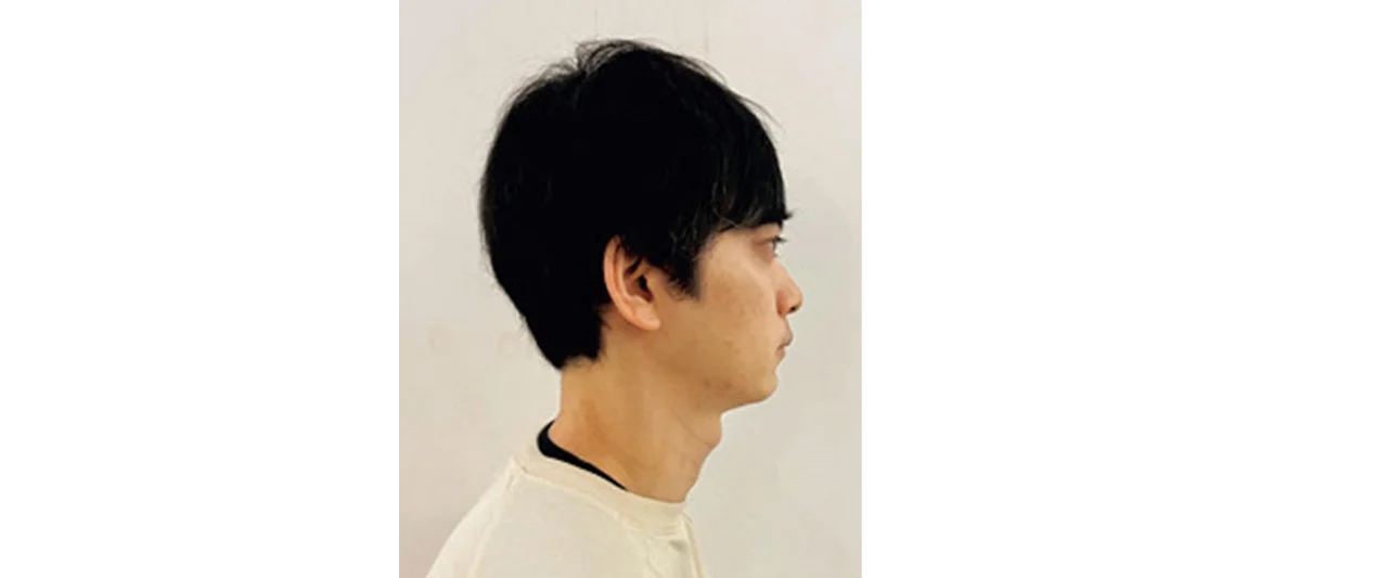 もみあげがうねる…ビフォー