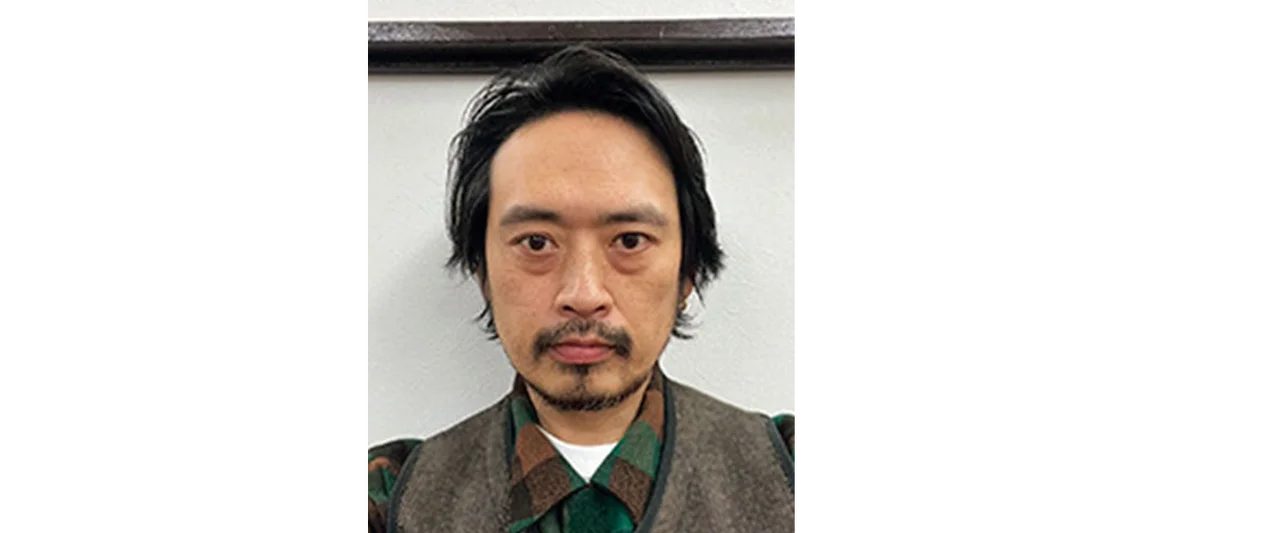 おでこ、広くなった？ビフォー