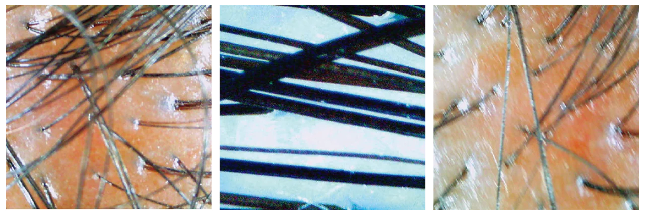 【頭髪ケアもルーティンの一部に!】はじめの画像_5